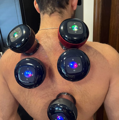 The Science of Serene: How Smart Cupping Therapy Works