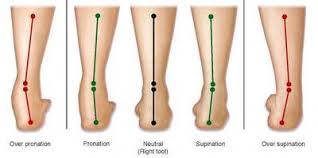 Foot Braces and Orthotics: Key Devices for Reducing Pain and Improving Alignment