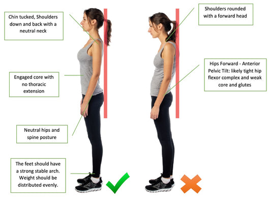 The Link Between Posture and Back Pain: How Foot Support Can Help